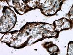 GDF15 Antibody in Immunohistochemistry (Paraffin) (IHC (P))