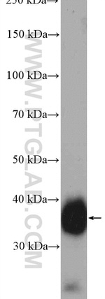 GDF15 Antibody in Western Blot (WB)