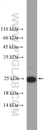 HMGB3 Antibody in Western Blot (WB)