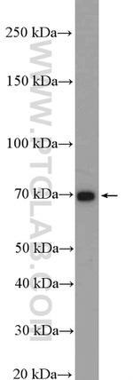 Kininogen 1 Antibody in Western Blot (WB)