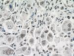 NDNL2 Antibody in Immunohistochemistry (Paraffin) (IHC (P))