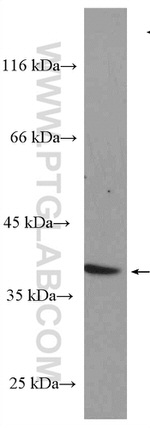 NDNL2 Antibody in Western Blot (WB)