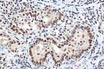 GTF3C2 Antibody in Immunohistochemistry (Paraffin) (IHC (P))