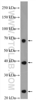 SLC31A1 Antibody in Western Blot (WB)