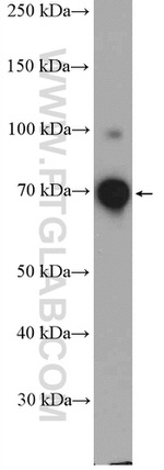 DDX41 Antibody in Western Blot (WB)