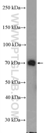 DDX41 Antibody in Western Blot (WB)