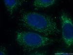 Interferon beta Antibody in Immunocytochemistry (ICC/IF)