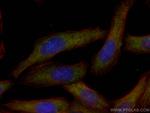 Interferon beta Antibody in Immunocytochemistry (ICC/IF)