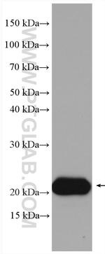 Interferon beta Antibody in Western Blot (WB)