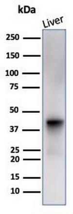 Glutamine Synthetase/GLUL Antibody in Western Blot (WB)