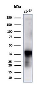 Glutamine Synthetase/GLUL Antibody in Western Blot (WB)