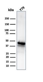 Glutamine Synthetase/GLUL Antibody in Western Blot (WB)