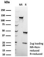 Glutamine Synthetase/GLUL Antibody in SDS-PAGE (SDS-PAGE)