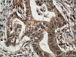 IRE1/ERN1 Antibody in Immunohistochemistry (Paraffin) (IHC (P))