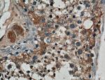 IRE1/ERN1 Antibody in Immunohistochemistry (Paraffin) (IHC (P))