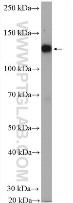 IRE1/ERN1 Antibody in Western Blot (WB)