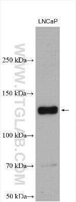 IRE1/ERN1 Antibody in Western Blot (WB)