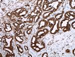 Livin Antibody in Immunohistochemistry (Paraffin) (IHC (P))