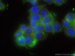 Galectin-4 Antibody in Immunocytochemistry (ICC/IF)