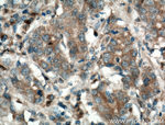 Galectin-4 Antibody in Immunohistochemistry (Paraffin) (IHC (P))