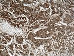 Galectin-4 Antibody in Immunohistochemistry (Paraffin) (IHC (P))