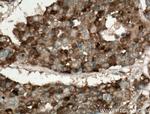 Galectin-4 Antibody in Immunohistochemistry (Paraffin) (IHC (P))