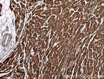 AKD2 Antibody in Immunohistochemistry (Paraffin) (IHC (P))