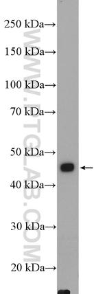 AKD2 Antibody in Western Blot (WB)