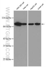 Alpha taxilin Antibody in Western Blot (WB)