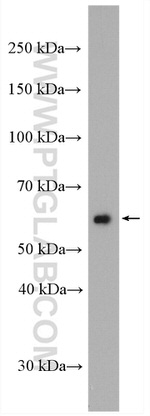 GLUT5 Antibody in Western Blot (WB)