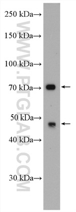 GLUT5 Antibody in Western Blot (WB)