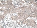 GLUT5 Antibody in Immunohistochemistry (Paraffin) (IHC (P))