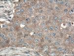 GLUT5 Antibody in Immunohistochemistry (Paraffin) (IHC (P))