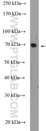 GLUT5 Antibody in Western Blot (WB)