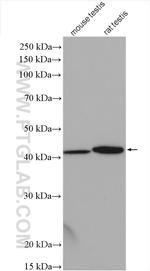 ARPM1 Antibody in Western Blot (WB)