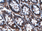 ARPM1 Antibody in Immunohistochemistry (Paraffin) (IHC (P))