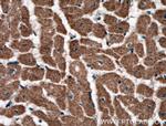 RYR2 Antibody in Immunohistochemistry (Paraffin) (IHC (P))