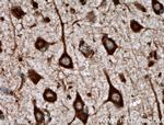 TREM2 Antibody in Immunohistochemistry (Paraffin) (IHC (P))