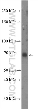 E2F3 Antibody in Western Blot (WB)