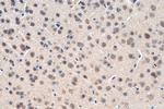 OPRM1 Antibody in Immunohistochemistry (Paraffin) (IHC (P))