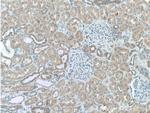 GSDMC Antibody in Immunohistochemistry (Paraffin) (IHC (P))