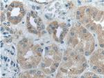 GSDMC Antibody in Immunohistochemistry (Paraffin) (IHC (P))