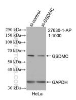 GSDMC Antibody in Western Blot (WB)