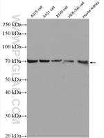 GSDMC Antibody in Western Blot (WB)