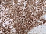 PIP5K1C Antibody in Immunohistochemistry (Paraffin) (IHC (P))