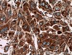 PIP5K1C Antibody in Immunohistochemistry (Paraffin) (IHC (P))