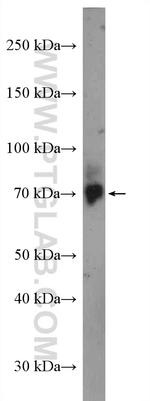 PIP5K1C Antibody in Western Blot (WB)