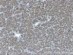 TAPT1 Antibody in Immunohistochemistry (Paraffin) (IHC (P))