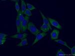 EIF3A Antibody in Immunocytochemistry (ICC/IF)