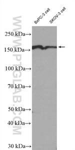 EIF3A Antibody in Western Blot (WB)